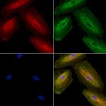 HADHA Antibody in Immunocytochemistry (ICC/IF)