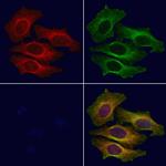 HADHA Antibody in Immunocytochemistry (ICC/IF)