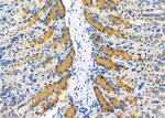 HADHA Antibody in Immunohistochemistry (Paraffin) (IHC (P))