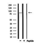 HADHA Antibody in Western Blot (WB)