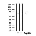 ATIC Antibody in Western Blot (WB)