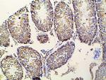 Ephrin B2 Antibody in Immunohistochemistry (Paraffin) (IHC (P))