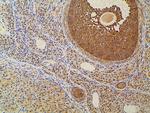 Ephrin B2 Antibody in Immunohistochemistry (Paraffin) (IHC (P))