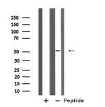 Cytokeratin 12 Antibody in Western Blot (WB)