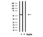 Cytokeratin 12 Antibody in Western Blot (WB)