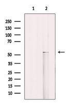 Cytokeratin 12 Antibody in Western Blot (WB)