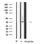 PP2A alpha/beta Antibody in Western Blot (WB)