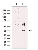 PP2A alpha/beta Antibody in Western Blot (WB)