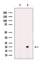 MRAP Antibody in Western Blot (WB)