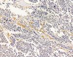 MRPL33 Antibody in Immunohistochemistry (Paraffin) (IHC (P))