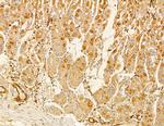 MRPL33 Antibody in Immunohistochemistry (Paraffin) (IHC (P))