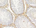 MRPL33 Antibody in Immunohistochemistry (Paraffin) (IHC (P))