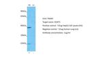 ADAT3 Antibody in Western Blot (WB)