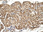 ATP Synthase beta Antibody in Immunohistochemistry (IHC)