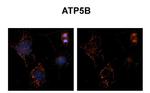 ATP Synthase beta Antibody in Immunohistochemistry (IHC)