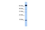 Dynein Antibody in Western Blot (WB)