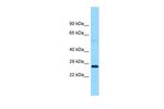 FTMT Antibody in Western Blot (WB)