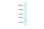 RPP21 Antibody in Western Blot (WB)