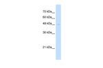 RTN2 Antibody in Western Blot (WB)