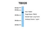 TBX20 Antibody in Western Blot (WB)