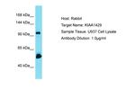 KIAA1429 Antibody in Western Blot (WB)