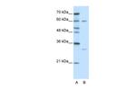 HDBP2 Antibody in Western Blot (WB)