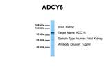 Adenylate Cyclase 6 Antibody in Western Blot (WB)