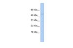 APOBEC3F Antibody in Western Blot (WB)