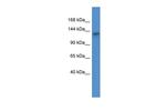 ATP11C Antibody in Western Blot (WB)