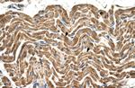 ATP Synthase beta Antibody in Immunohistochemistry (IHC)