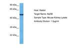 ATP Synthase beta Antibody in Western Blot (WB)