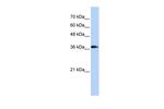 ATP6V0D2 Antibody in Western Blot (WB)