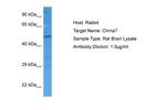 CHRNA7 (extracellular) Antibody in Western Blot (WB)