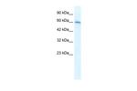 CHRNA7 Antibody in Western Blot (WB)