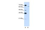 CPEB2 Antibody in Western Blot (WB)