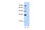 EXOSC6 Antibody in Western Blot (WB)