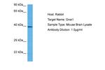 GNAI1 Antibody in Western Blot (WB)