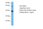 GNAI1 Antibody in Western Blot (WB)