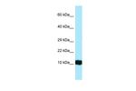 HBG2 Antibody in Western Blot (WB)