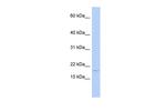 ISCA2 Antibody in Western Blot (WB)