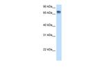 LSR Antibody in Western Blot (WB)