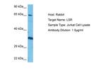 LSR Antibody in Western Blot (WB)