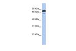 MTMR12 Antibody in Western Blot (WB)