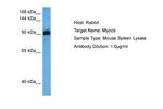 MYOCD Antibody in Western Blot (WB)