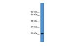 SDOS Antibody in Western Blot (WB)