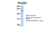 PLAG1 Antibody in Western Blot (WB)