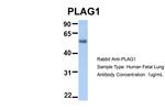 PLAG1 Antibody in Western Blot (WB)