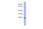 RBM38 Antibody in Western Blot (WB)