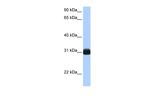 RBPMS Antibody in Western Blot (WB)