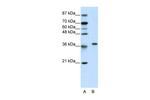 RPL6 Antibody in Western Blot (WB)